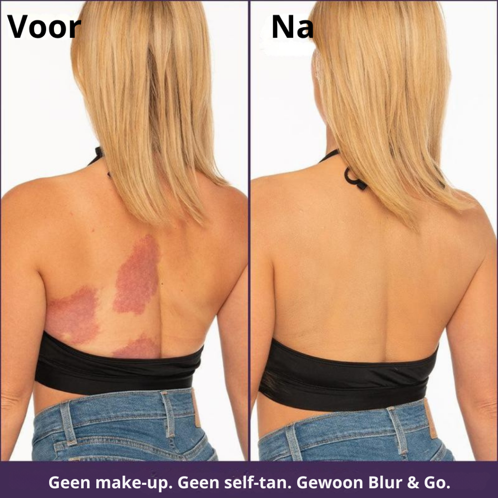 Blur & Go Body Blur